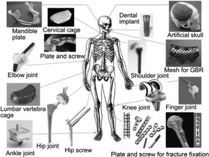 استیل 316 در بدن انسان
