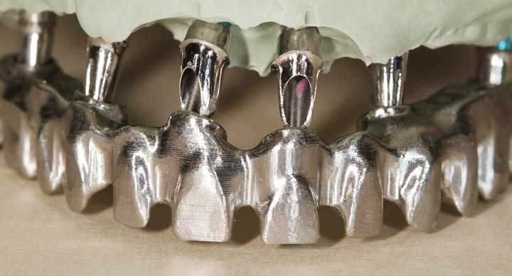 کاربرد استیل 316 در دندان انسان