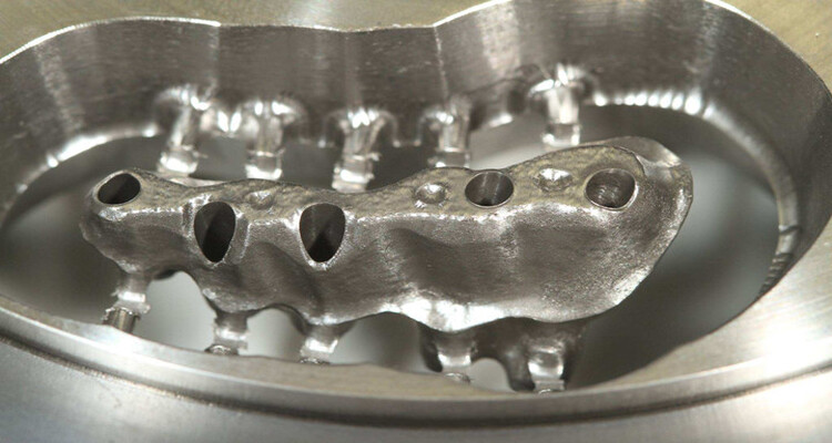 کاربردهای پنهان استیل ۳۱۶ در بدن انسان: از ایمپلنتهای جراحی تا دستگاههای ارتودنسی ثابت